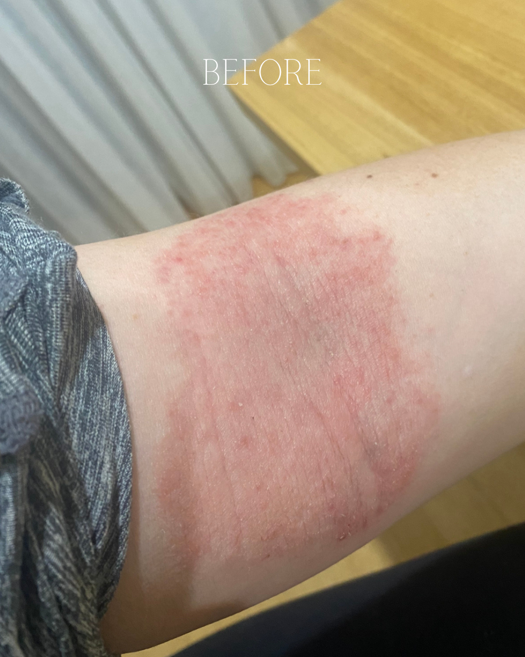Tallow Cream (Eczema & Psoriasis Safe)