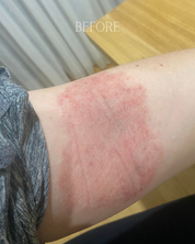Tallow Cream (Eczema & Psoriasis Safe)