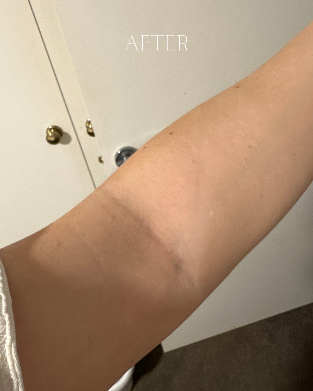 Tallow Cream (Eczema & Psoriasis Safe)
