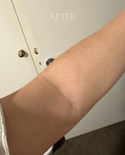 Tallow Cream (Eczema & Psoriasis Safe)