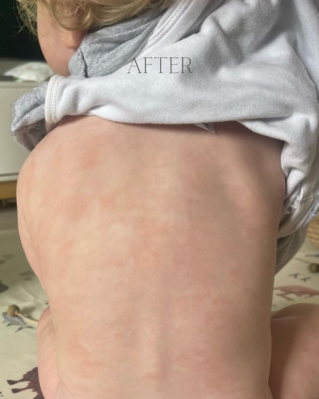 Person wearing a gray hoodie with 'AFTER' text, after using tallow balm on skin