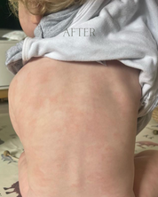 Person wearing a gray hoodie with 'AFTER' text, after using tallow balm on skin