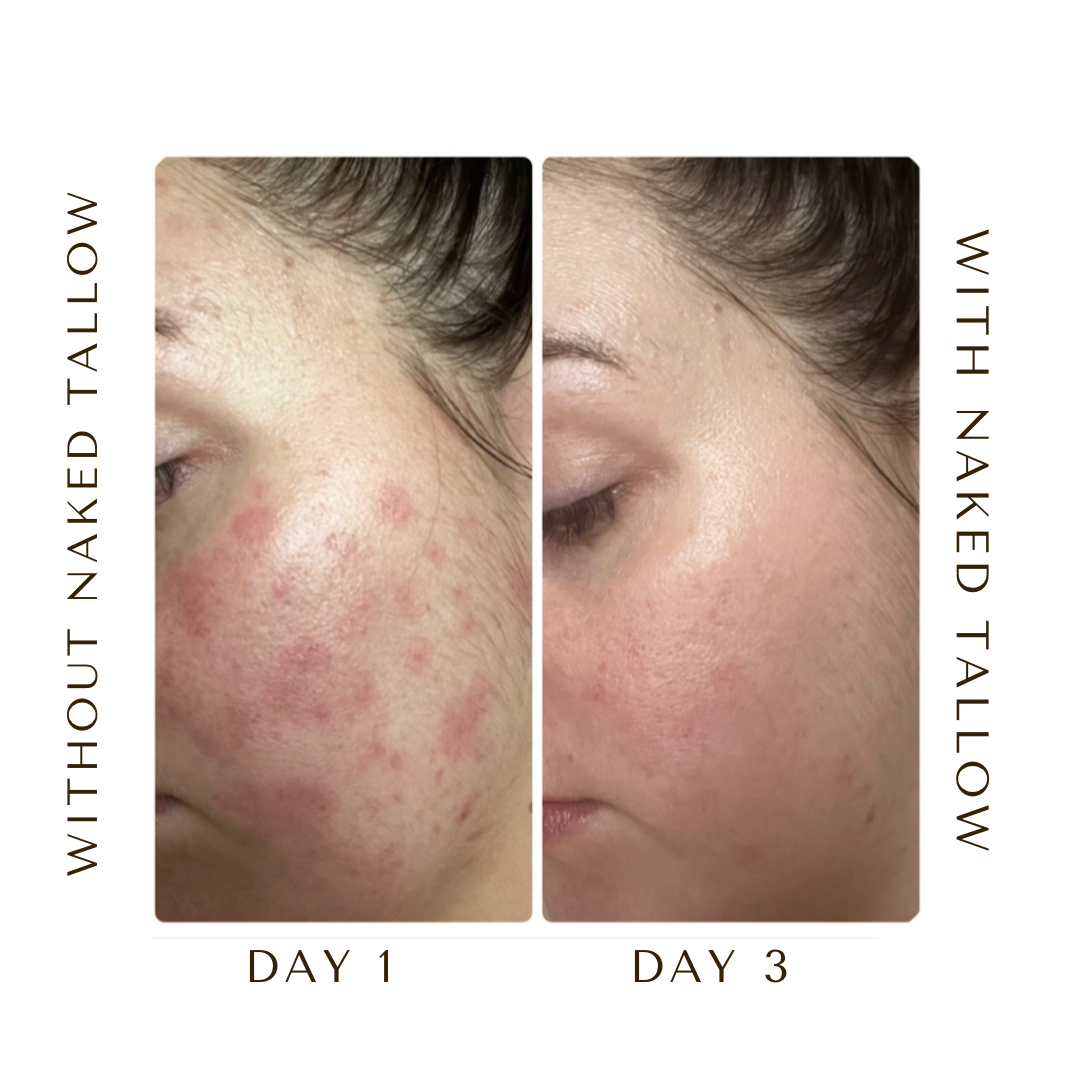 beef tallow for skin before and after results