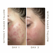 beef tallow for skin before and after results